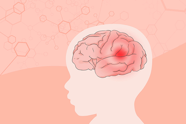 脑梗死发生率提高的原因是什么？