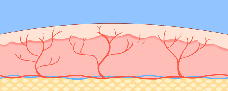 毛细血管扩张能自愈吗}