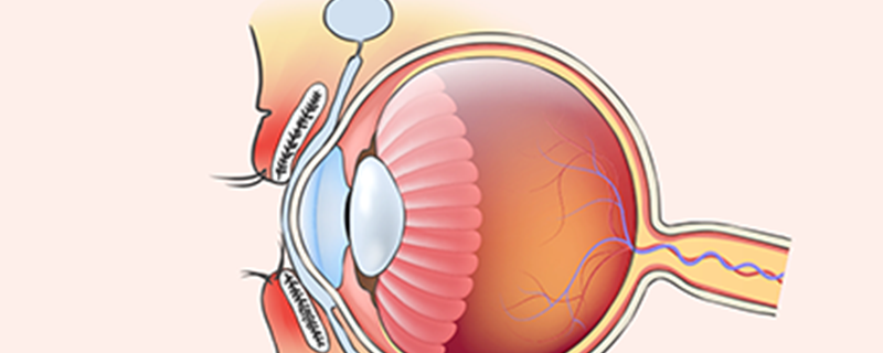 先天性視神經發育不良能治愈嗎