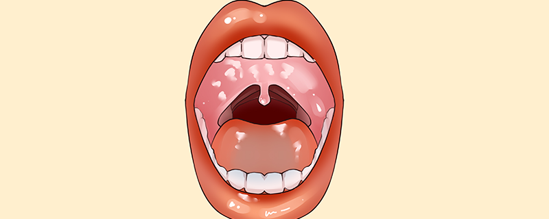 舌頭是黑色的怎么回事