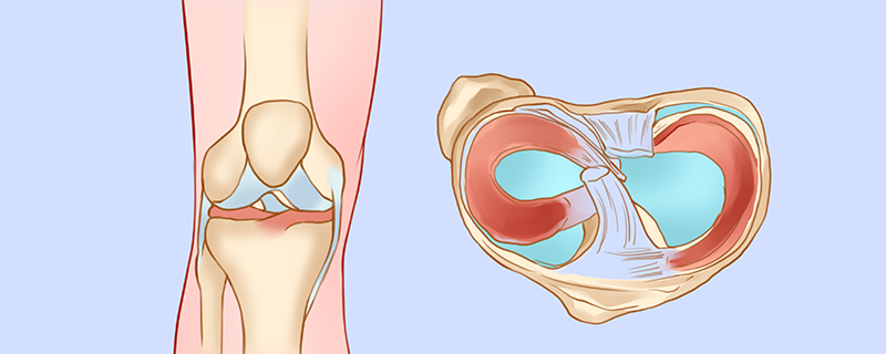 膝关节关节囊薄而松弛是怎么回事，怎么办}
