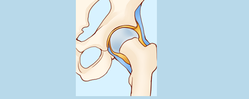 髋关节囊肿需要做手术吗