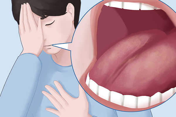 舌癌需要要长期服药吗