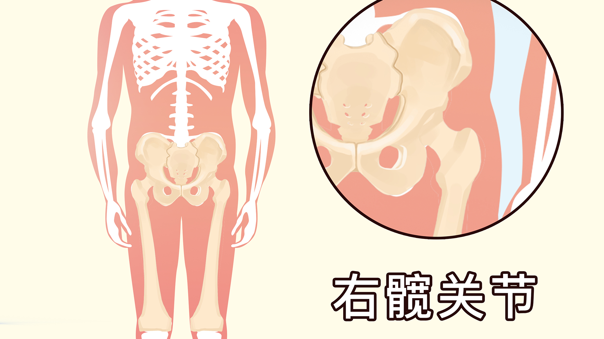 環(huán)跳酸痛與婦科有關(guān)嗎}