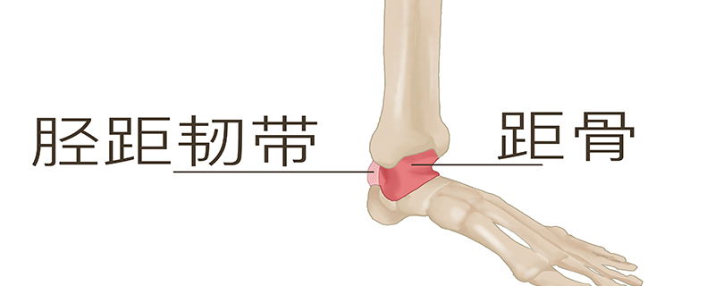 距骨挫傷怎么回事，怎么治療