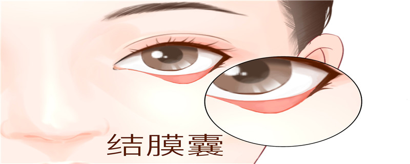 小孩老眨眼睛什么原因