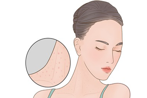 皮肤过敏症状图片 皮肤过敏症状有哪些表现