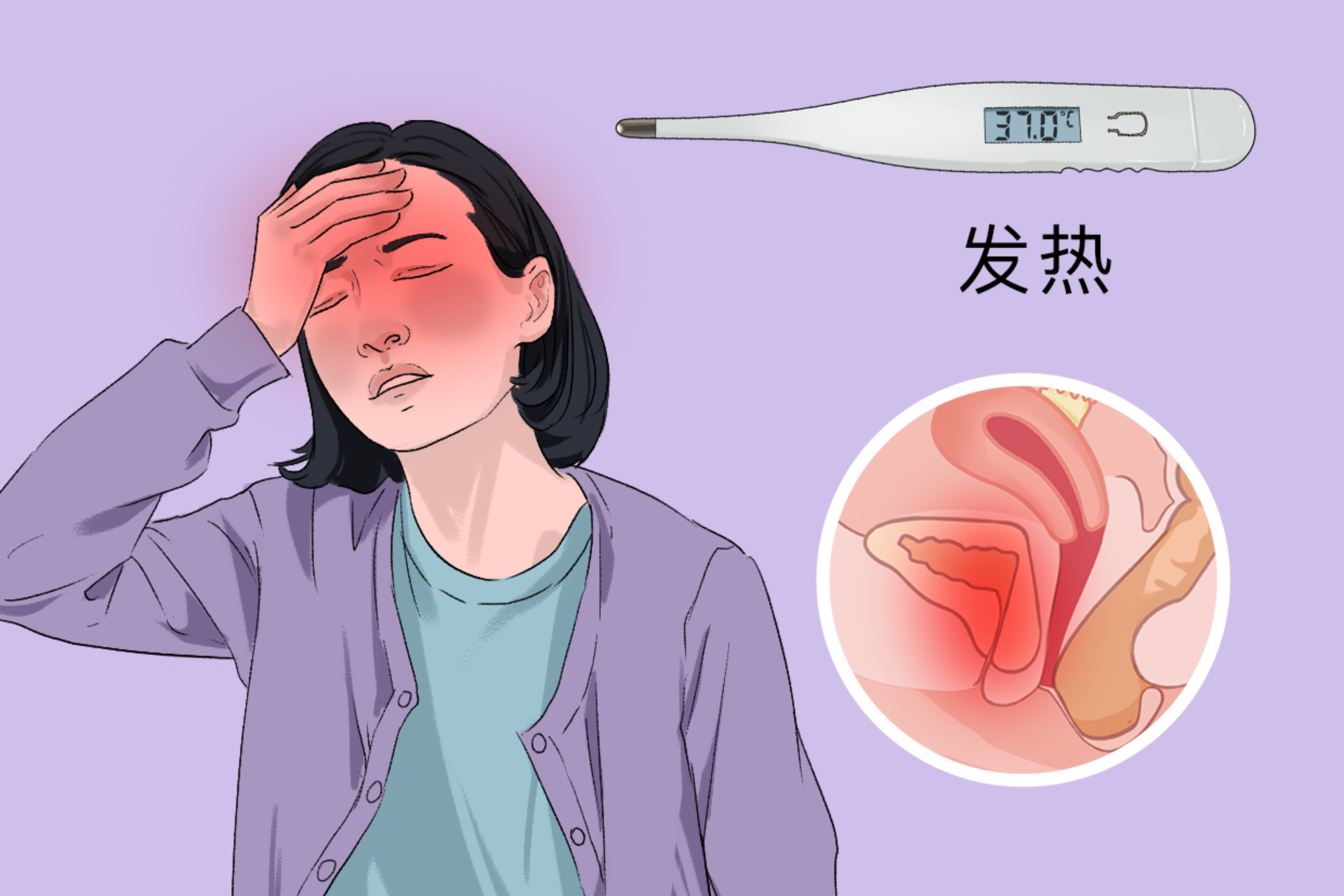 拉肚子发烧38℃用吃退烧药吗