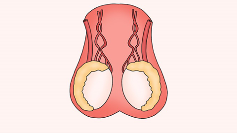 睾丸下垂图片大型图片